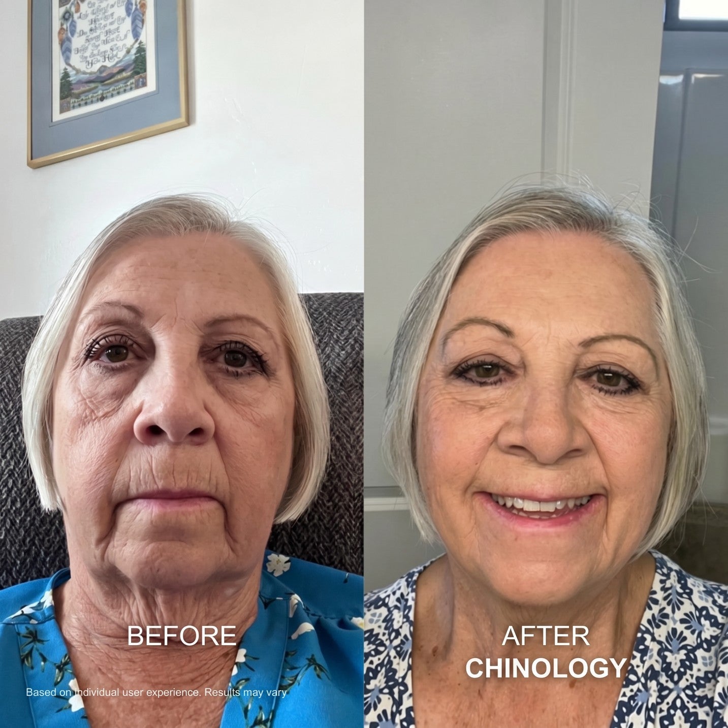 The Chinology™ Lift (New Version · 2026)