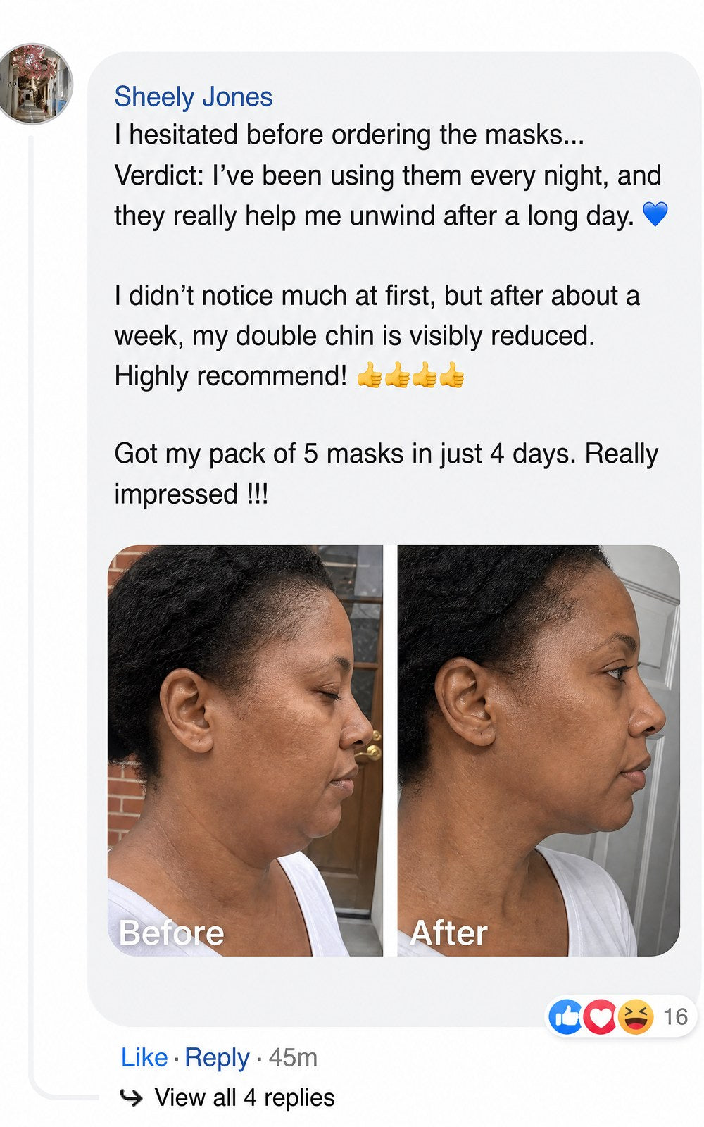Before and after profile photos showing reduced double chin after using masks.