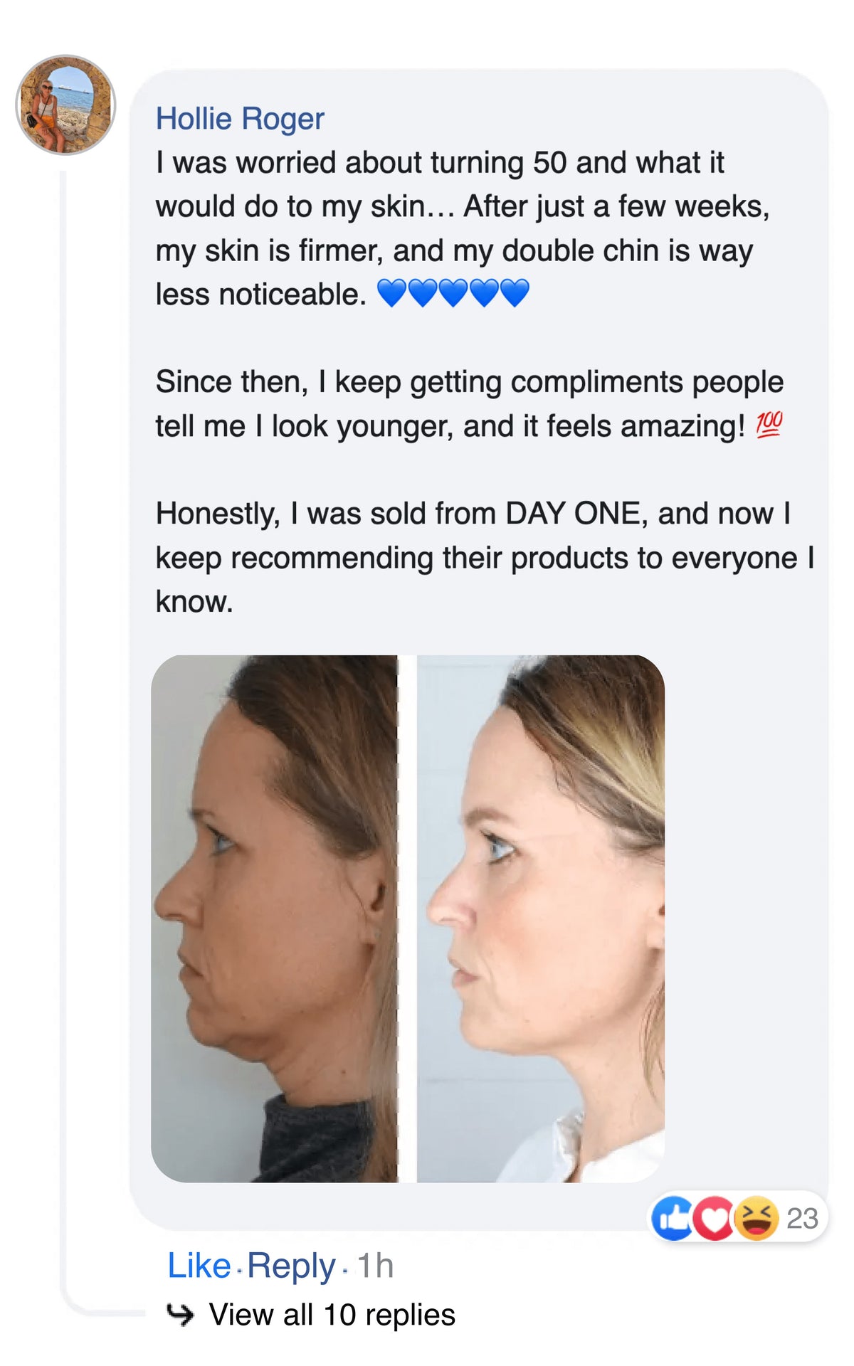 A Facebook comment with skincare product endorsement and a side-by-side profile comparison photo.