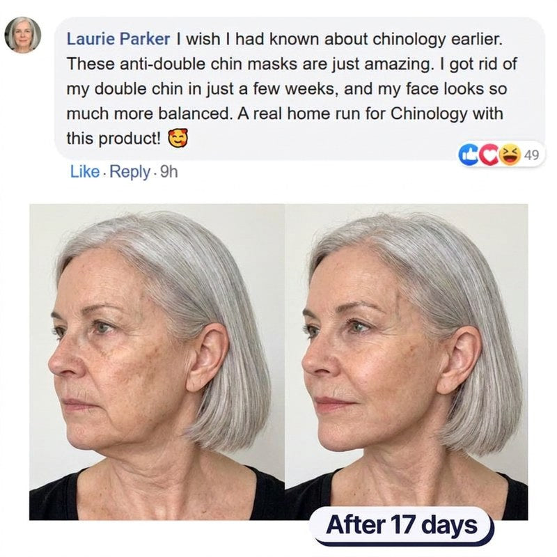 Before and after photos of a woman in her sixties showing a firmer jawline after 17 days.