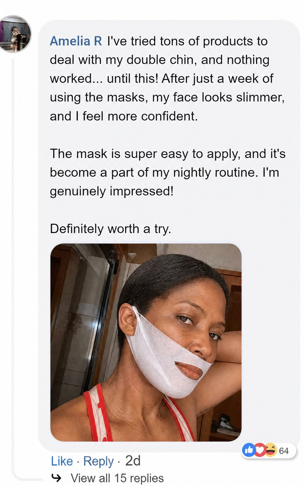 Before and after photos showing visible reduction in double chin.