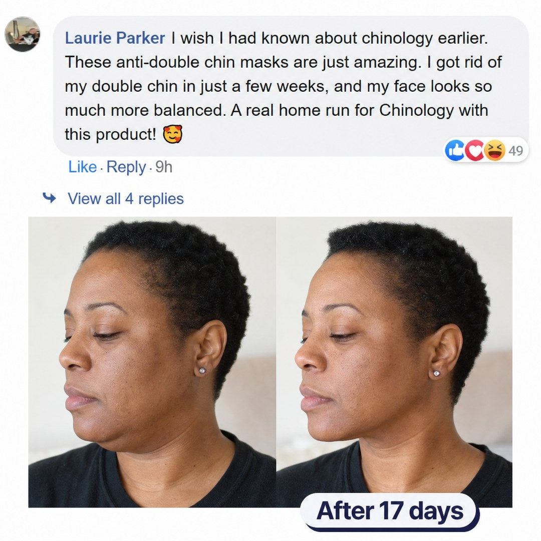 Before and after photos showing chin enhancement after using skincare product for 17 days.