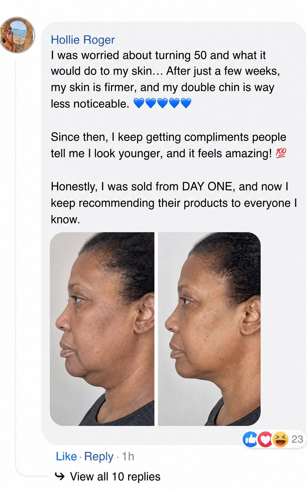 A Facebook comment with skincare product endorsement and a side-by-side profile comparison photo.