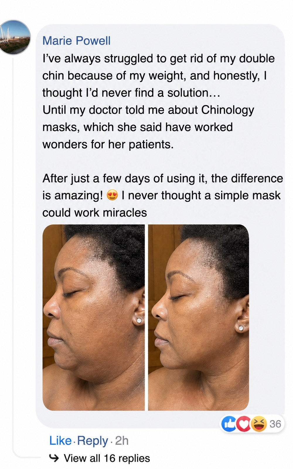 Side-by-side comparison of a woman's face before and after using a product.