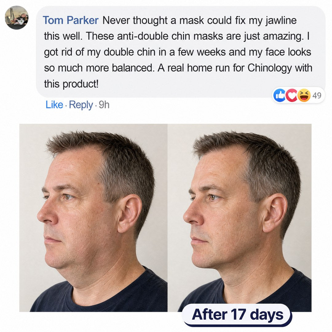 Before and after photos showing chin enhancement after using skincare product for 17 days.