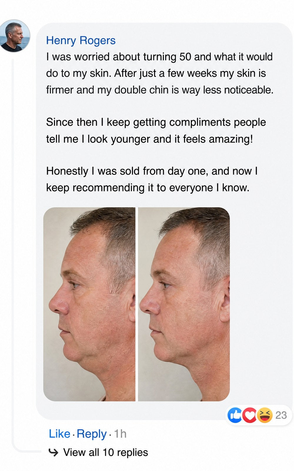 A Facebook comment with skincare product endorsement and a side-by-side profile comparison photo.