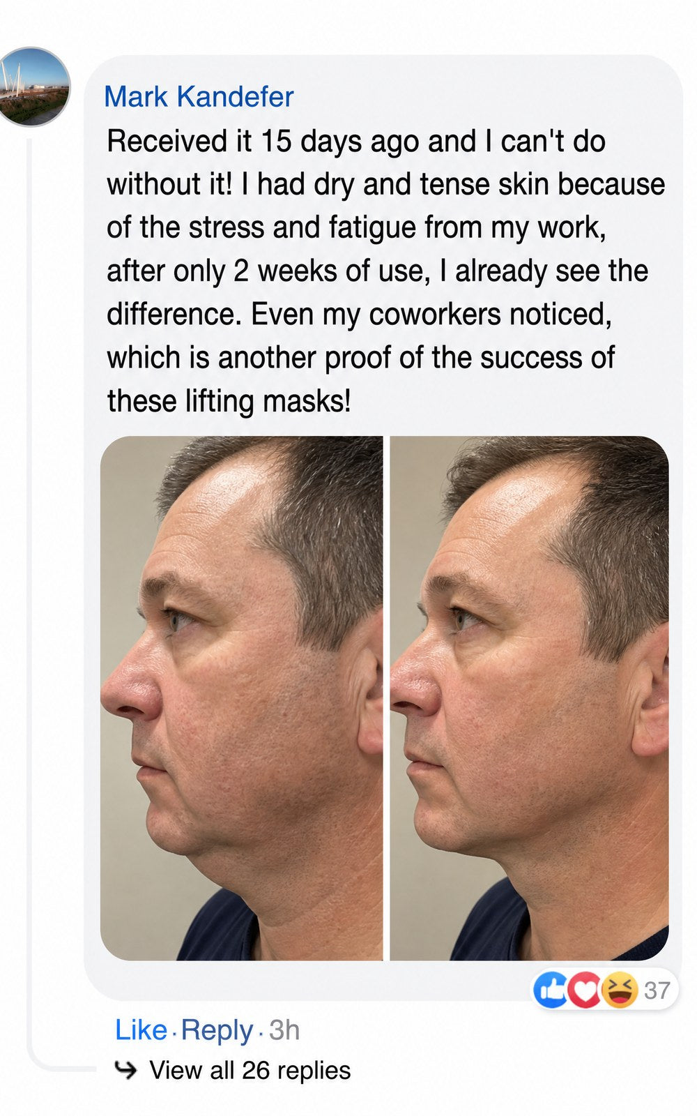 Side-by-side comparison of a woman's face before and after using a product.