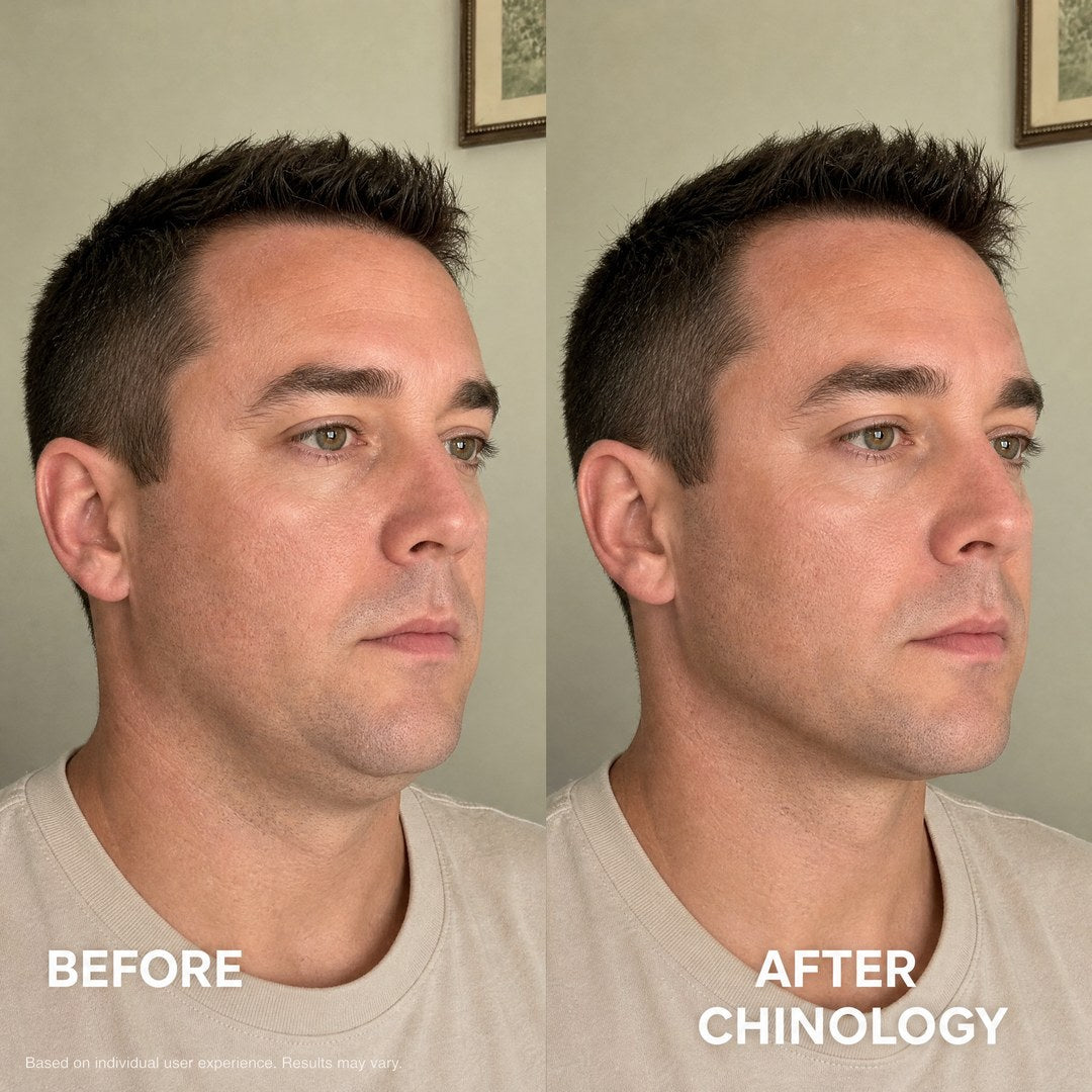 The Chinology™ Lift (v3) Chinology US