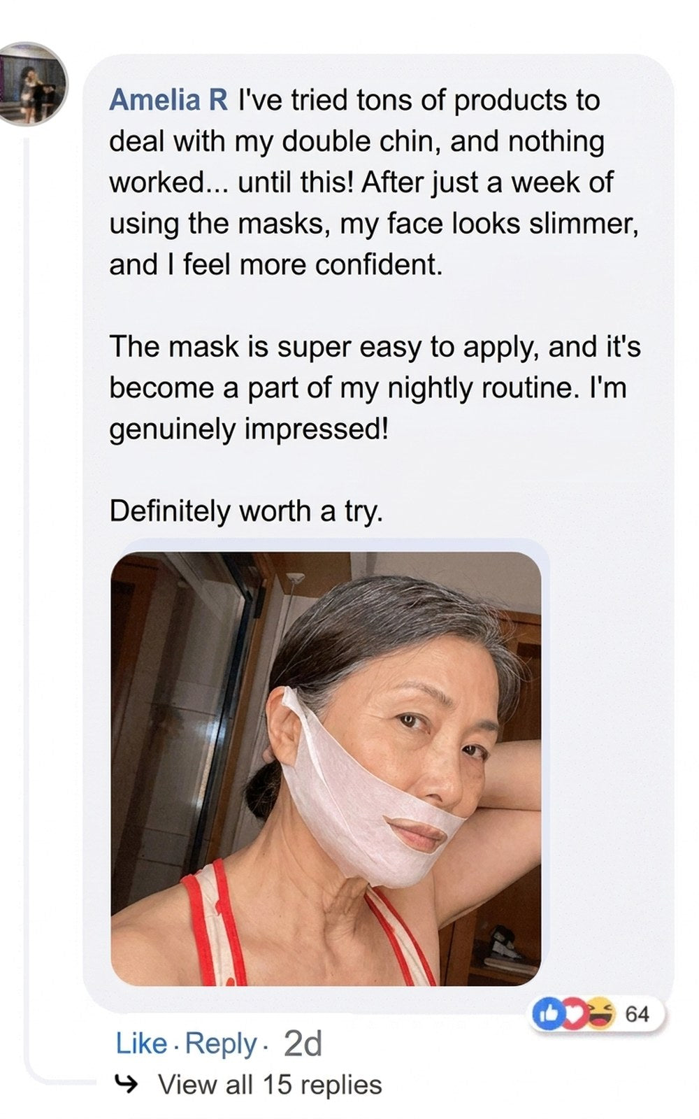 Before and after photos showing visible reduction in double chin.