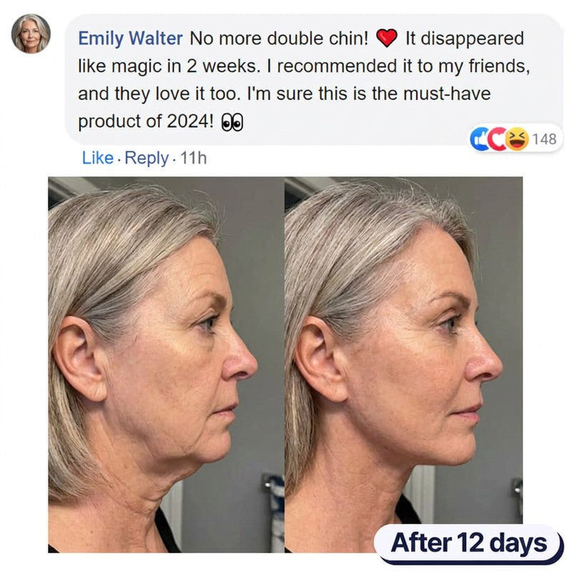Before and after photos of a woman in her sixties showing her double chin gone after 12 days.
