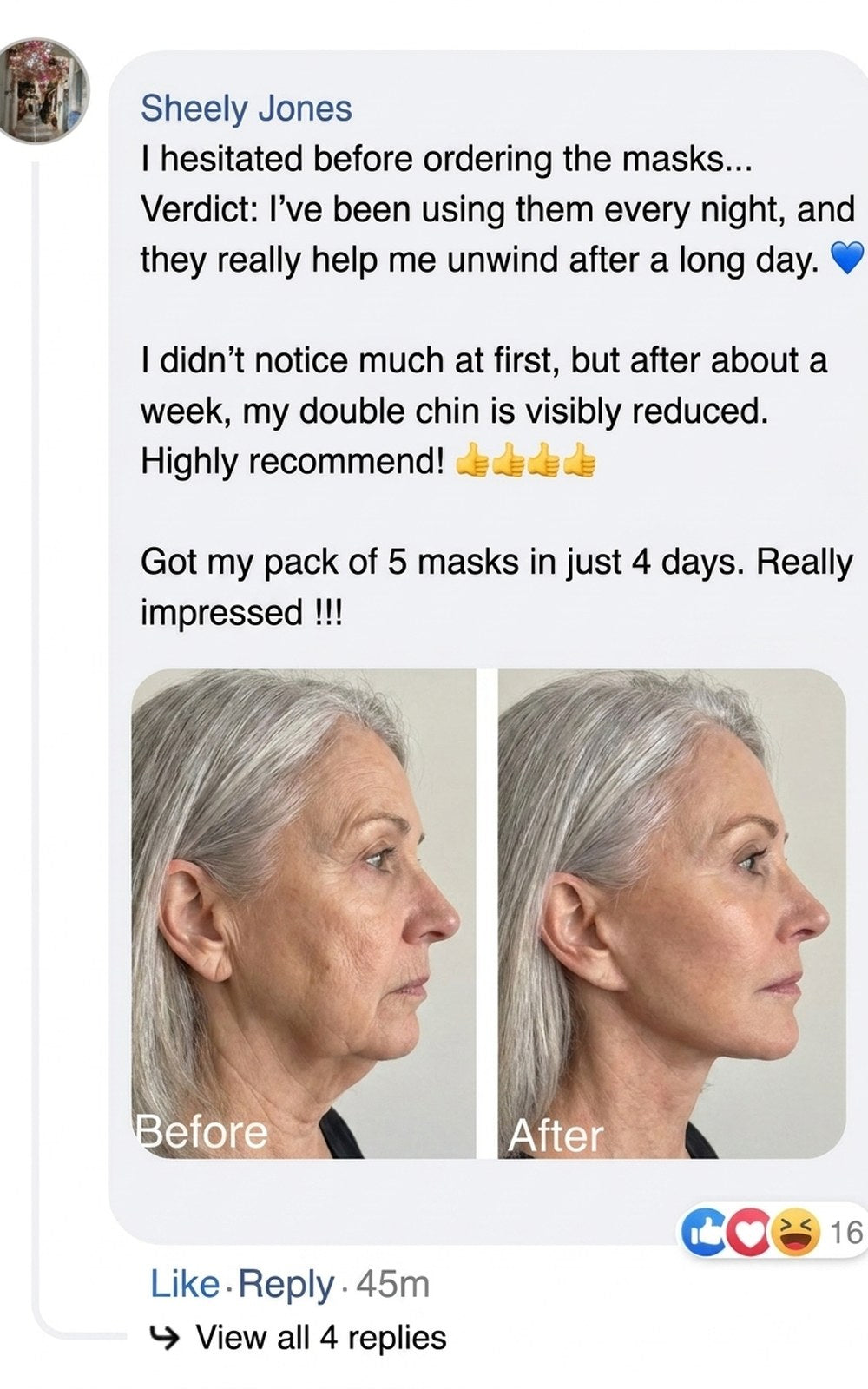 Before and after profile photos showing reduced double chin after using masks.