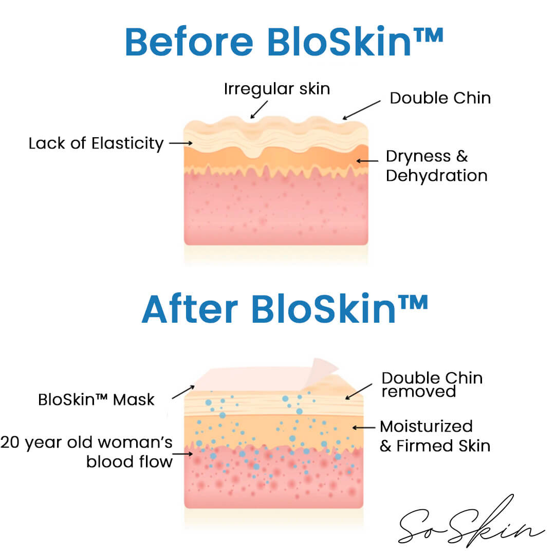 BloSkin™ Lift